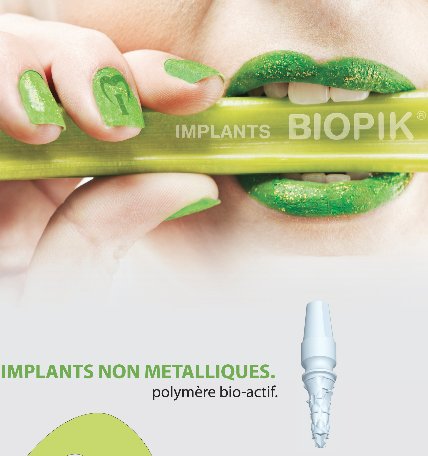 implant biopik